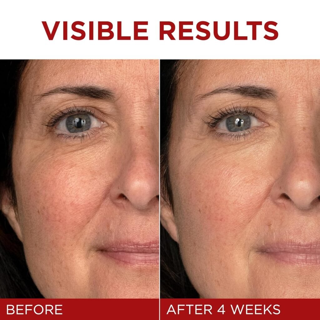 L'Oreal Paris Revitalift Triple Power